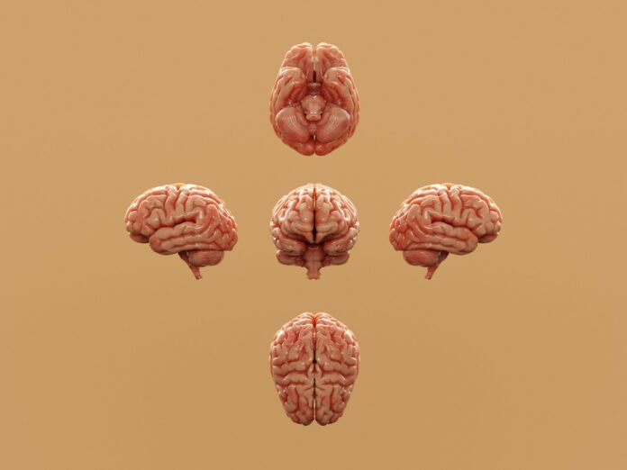 Various perspectives of a human brain are displayed.