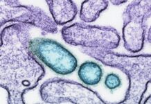 한국, 니파 바이러스 ‘제1군 감염병’ 지정… 최고 수준 대응 체계 가동 a close up of an animal cell with blue cells